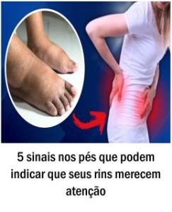 5 sinais nos pés que podem indicar que seus rins merecem atenção