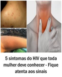 5 sintomas do HIV que toda mulher deve conhecer – Fique atenta aos sinais