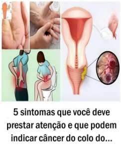 Câncer do colo do útero: 5 sinais que merecem atenção e a importância da prevenção
