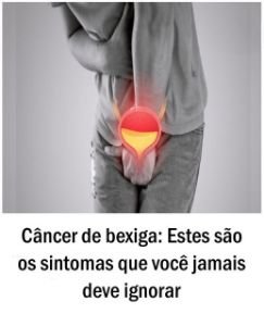 Câncer de bexiga: Estes são os sintomas que você jamais deve ignorar