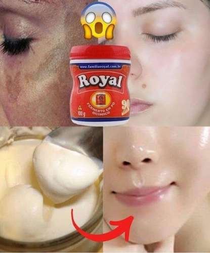 Pele de Bebê em Poucos Dias: Use Isso para Remover Manchas e Rugas da Pele