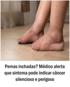Pernas inchadas podem indicar a presença de câncer silencioso e letal; todo cuidado é pouco