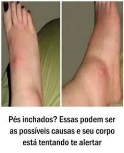Pés inchados? Essas podem ser as possíveis causas e seu corpo está tentando te alertar