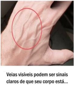 Veias visíveis podem ser sinais claros de que seu corpo está te alertando